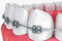 ORTHODONTICS